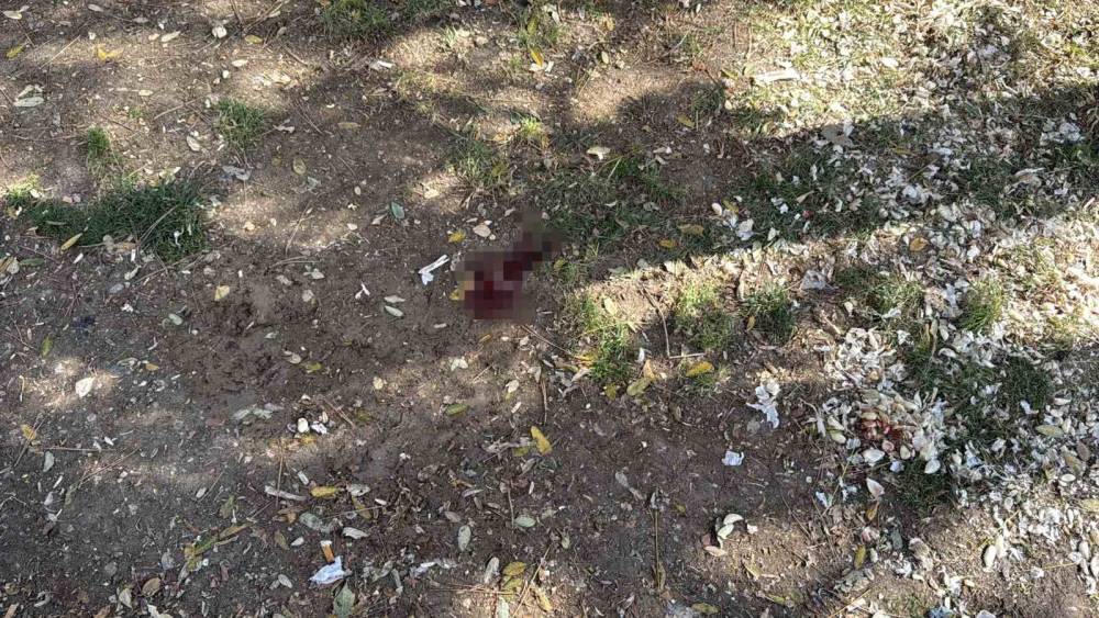 Eskişehir&rsquo;de parkta bı&ccedil;aklı saldırı: Bir ş&uuml;pheli yakalandı