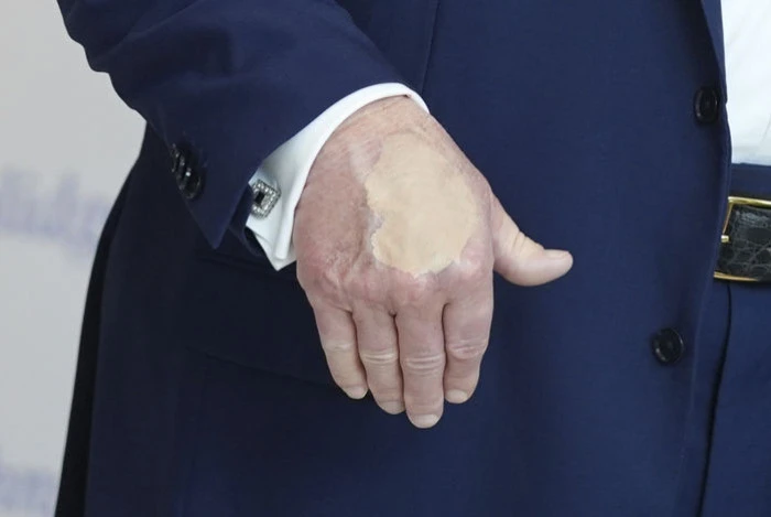 Yeni Bir Epstein Vakası mı? Trump’ın Elindeki Morluklar Tartışma Yarattı